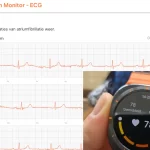 ECG op Galaxy Watch Ultra