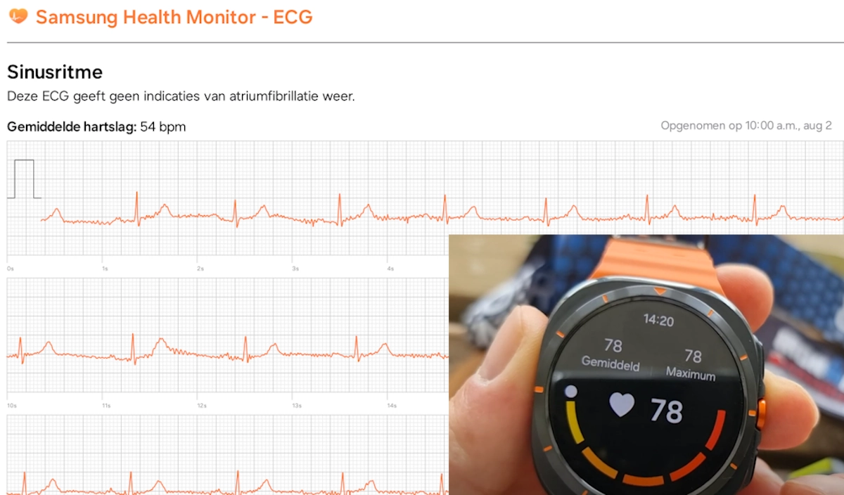 ECG op Galaxy Watch Ultra